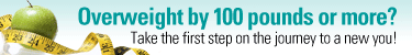 Overweight by 100 pounds or more?
