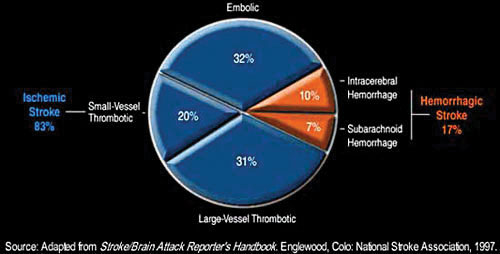 Ischemic
