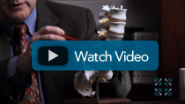 Spinal Stenosis Video