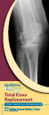 Total Hip Replacement Instructional Guide