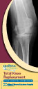 Total Hip Replacement Instructional Guide