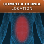 Complex Hernia Location
