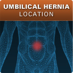 Umbilical Hernia Location